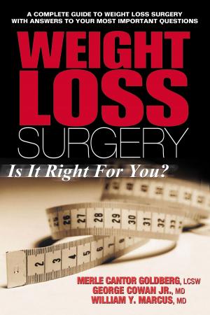 Book cover of Weight Loss Surgery