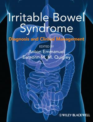 Cover of the book Irritable Bowel Syndrome by Michael B. First, Allan Tasman