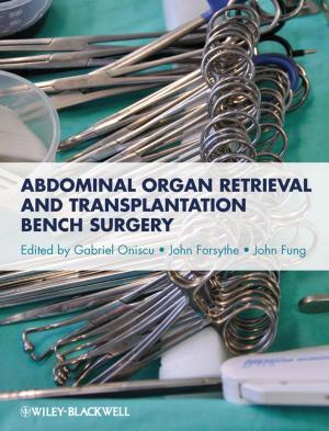 Cover of the book Abdominal Organ Retrieval and Transplantation Bench Surgery by Thomas J. Saporito, Paul Winum