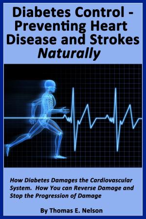 Cover of the book Diabetes Control- Preventing Heart Disease and Strokes Naturally by Julie Cantrell
