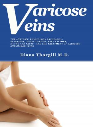 Cover of the book Varicose Veins: The Anatomy, Physiology Pathology, Diagnosis, Complications, Risk Factors, Myths and Facts and the Treatment of Varicose and Spider Veins by Cathy Chiu