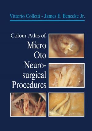 Cover of the book Colour Atlas of Micro-Oto-Neurosurgical Procedures by Charles V. Mann, Richard E. Glass