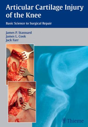 Cover of the book Articular Cartilage Injury of the Knee: Basic Science to Surgical Repair by 