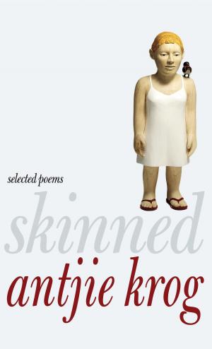Book cover of Skinned