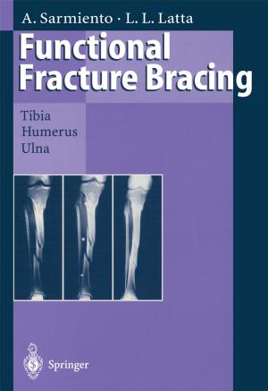 Cover of the book Functional Fracture Bracing by J.M. Schröder