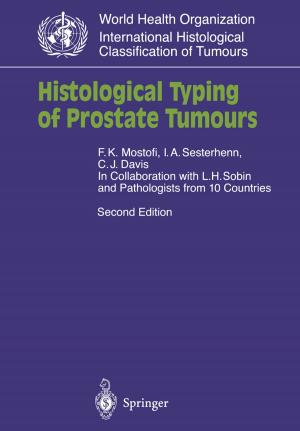 Book cover of Histological Typing of Prostate Tumours