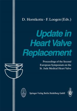 Cover of the book Update in Heart Valve Replacement by Weber, Laczkovics, Glogar, Scheibelhofer, Steinbach