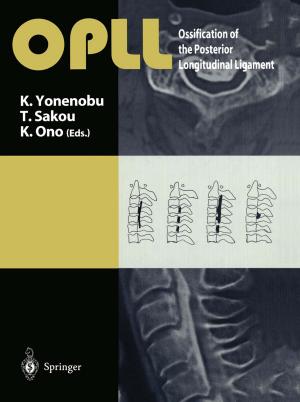Cover of the book OPLL by J.M. Anderson, L.H. Cohn, P.L. Frommer, M. Hachida, K. Kataoka, S. Nitta, C. Nojiri, D.B. Olsen, D.G. Pennington, S. Takatani, R. Yozu
