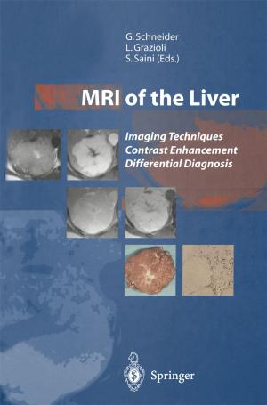 Cover of the book MRI of the Liver by Daniele Fabrizio Bignami