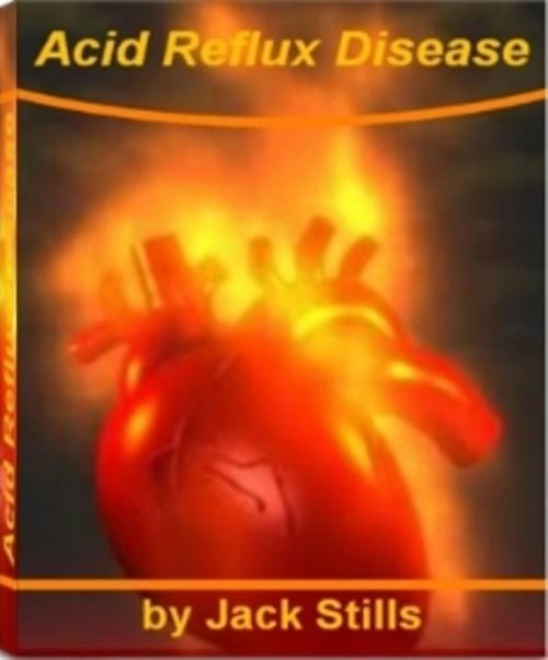 Cover of the book Acid Reflux Disease by Jack Stills, Tru Divine Publishing