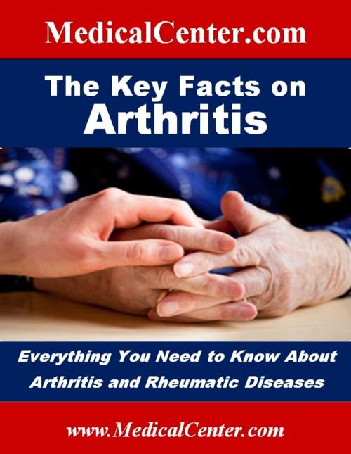 Cover of the book The Key Facts on Arthritis by Patrick W. Nee, The Internationalist