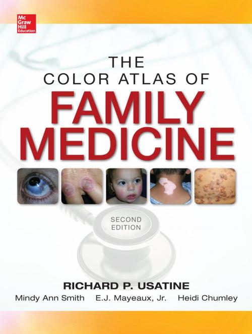 Cover of the book Color Atlas of Family Medicine 2/E by Richard Usatine, Mindy Ann Smith, Jr. E.J. Mayeaux, Heidi Chumley, Mcgraw-hill