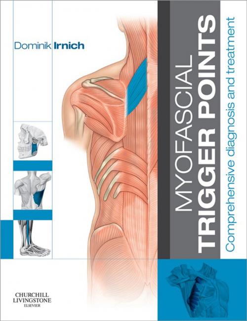 Cover of the book Myofascial Trigger Points - E-Book by Dominik Irnich, MD, Elsevier Health Sciences