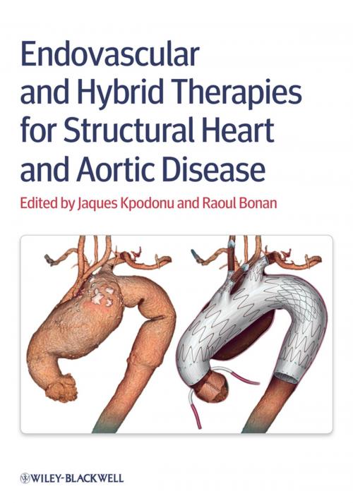 Cover of the book Endovascular and Hybrid Therapies for Structural Heart and Aortic Disease by , Wiley