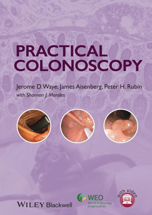 Cover of the book Practical Colonoscopy by Jerome D. Waye, James Aisenberg, Peter H. Rubin, Wiley