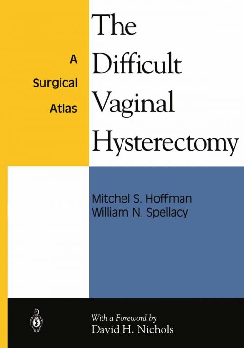 Cover of the book The Difficult Vaginal Hysterectomy by William N. Spellacy, Mitchel S. Hoffman, Springer New York