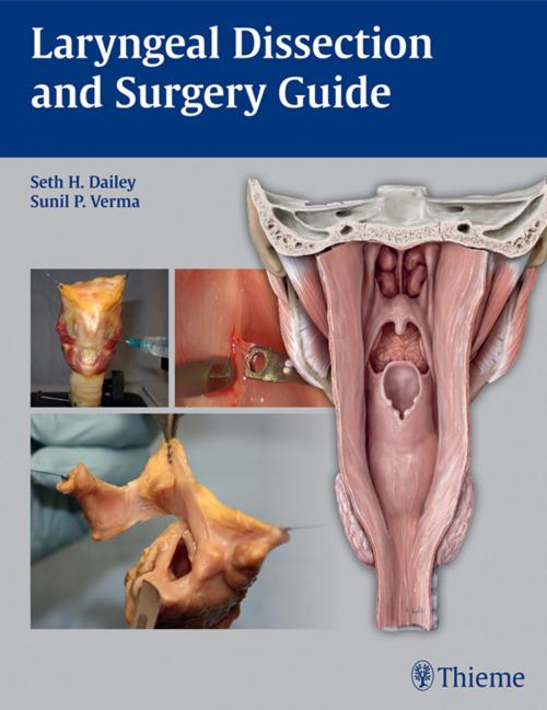 Cover of the book Laryngeal Dissection and Surgery Guide by , Thieme