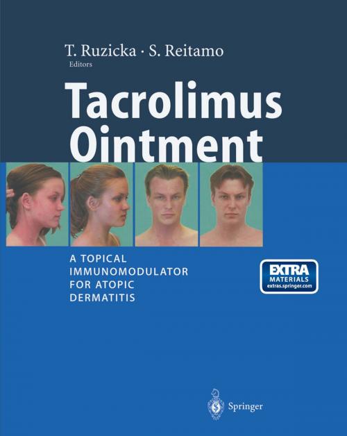 Cover of the book Tacrolimus Ointment by , Springer Berlin Heidelberg