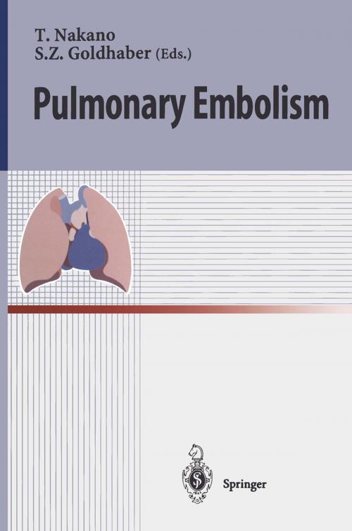 Cover of the book Pulmonary Embolism by , Springer Japan