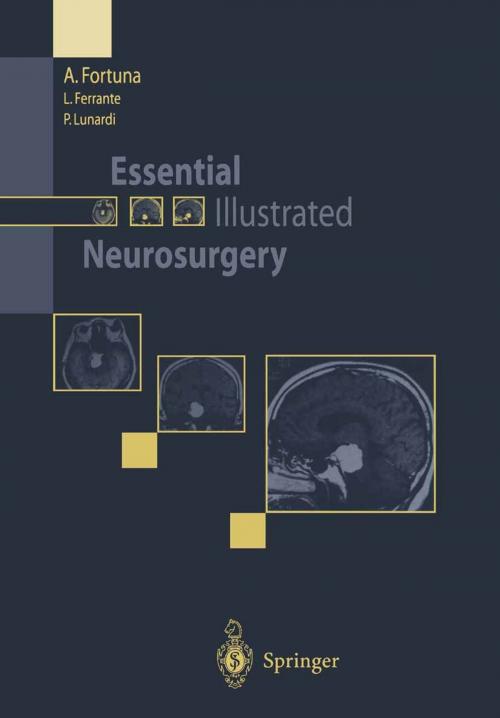 Cover of the book Essential Illustrated Neurosurgery by L. Ferrante, A. Fortuna, P. Lunardi, Springer Milan