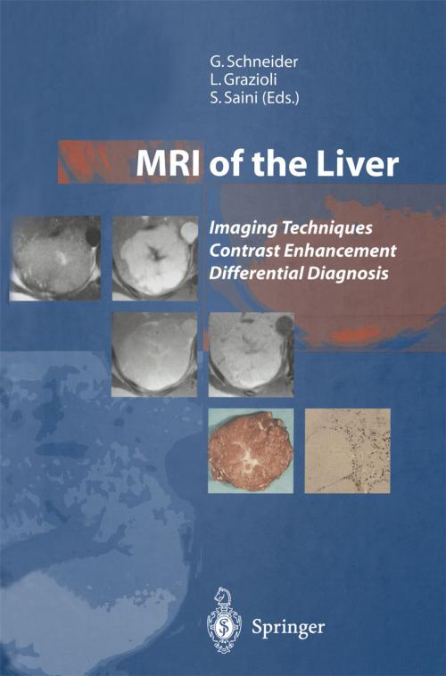 Cover of the book MRI of the Liver by D.R. Martin, L. Olivetti, A. Luca, M. Kirchin, A. Massmann, R. Seidel, L. Romanini, P. Fries, P. Caccia, M.P. Bondioni, K. Altmeyer, M. Harisinghani, R.V. D'Souza, D. Sahani, Springer Milan