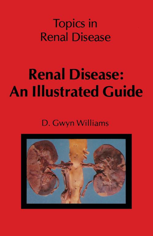 Cover of the book Renal Disease: An Illustrated Guide by D.G. Williams, Springer Netherlands