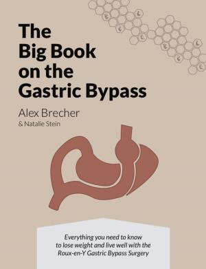 Book cover of The Big Book on the Gastric Bypass