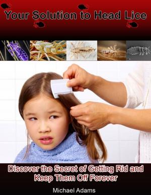 Cover of the book Your Solution to Head Lice: Discover the Secret of Getting Rid and Keep Them Off Forever by John O'Loughlin