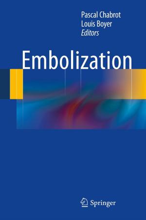 Cover of the book Embolization by J.F. Jensen, E. Kjems, N. Lehmann, C. Madsen