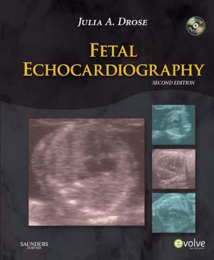 Cover of the book Fetal Echocardiography - E-Book by Gregory Y. H. Lip, John E. Hall, PhD