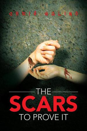 Book cover of The Scars to Prove It