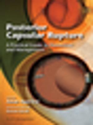 Cover of the book Posterior Capsular Rupture by Eric Esrailian