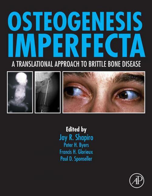 Cover of the book Osteogenesis Imperfecta by Jay R. Shapiro, MD, Elsevier Science