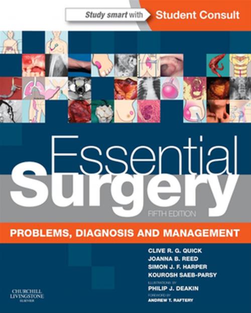 Cover of the book Essential Surgery E-Book by Simon J.F. Harper, MB ChB BSc FRCS MD, Kourosh Saeb-Parsy, MA MB BChir FRCS PhD, Elsevier Health Sciences
