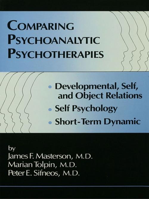 Cover of the book Comparing Psychoanalytic Psychotherapies: Development by , Taylor and Francis