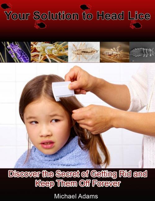 Cover of the book Your Solution to Head Lice: Discover the Secret of Getting Rid and Keep Them Off Forever by Michael Adams, Lulu.com