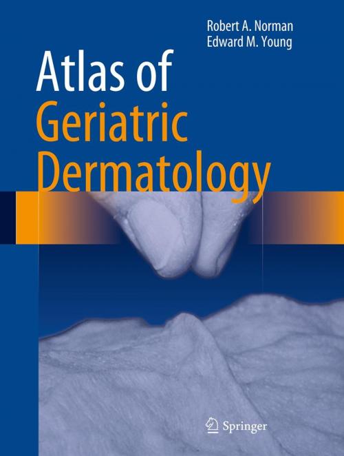 Cover of the book Atlas of Geriatric Dermatology by Robert A. Norman, Edward M. Young, Jr, Springer London