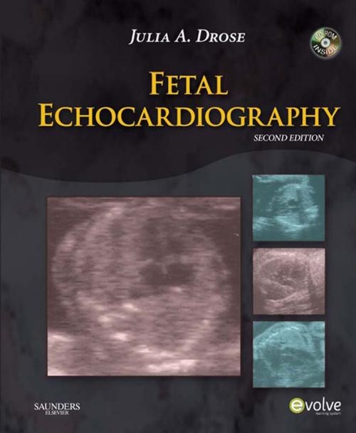Cover of the book Fetal Echocardiography - E-Book by Julia A. Drose, BA, RDMS, RDCS, RVT, Elsevier Health Sciences