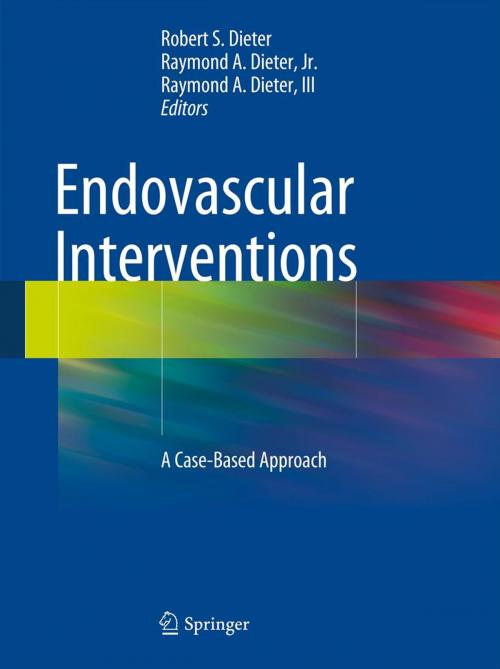 Cover of the book Endovascular Interventions by Aravinda Nanjundappa, Springer New York