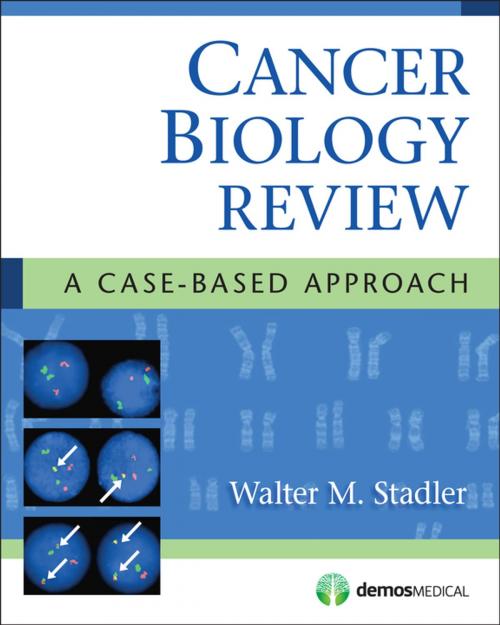 Cover of the book Cancer Biology Review by Walter Stadler, MD, Springer Publishing Company