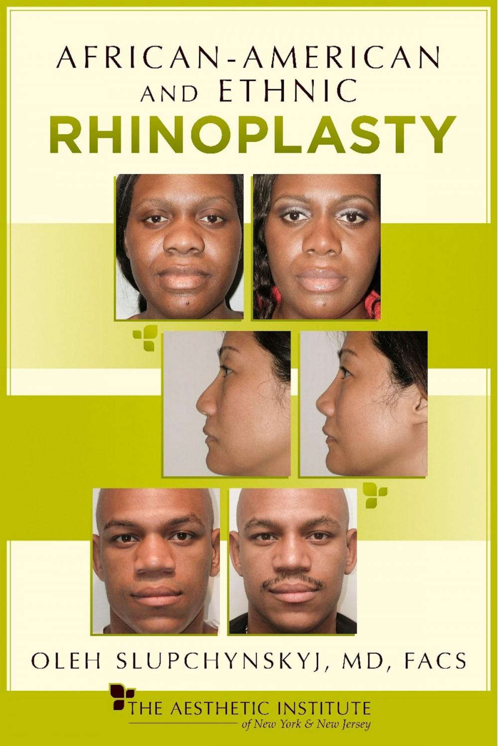 Big bigCover of African-American and Ethnic Rhinoplasty