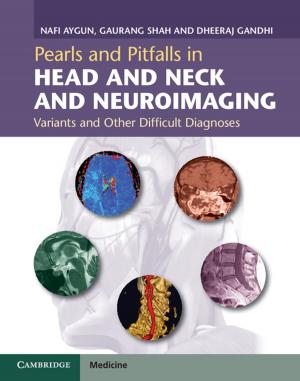 Cover of the book Pearls and Pitfalls in Head and Neck and Neuroimaging by Cambridge University Press