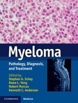 Cover of the book Myeloma by Judith Bannister, Anna Olijnyk, Stephen McDonald