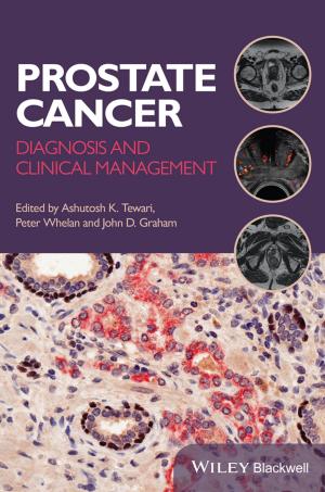 Cover of the book Prostate Cancer by Pablo Angueira, Juan Romo