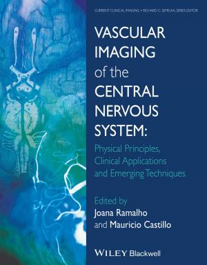 Cover of the book Vascular Imaging of the Central Nervous System by Elena Aguilar