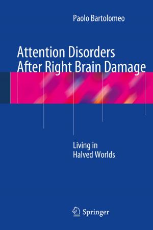 Cover of the book Attention Disorders After Right Brain Damage by Jorge Sousa Pinto, Maria João Frade, Simão Melo de Sousa, José Bacelar Almeida