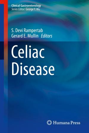Cover of the book Celiac Disease by Srdjan Stojanovic