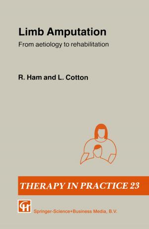 Cover of the book Limb Amputation by R.L. Amdur, William S. Davidson, C.M. Mitchell, R. Redner
