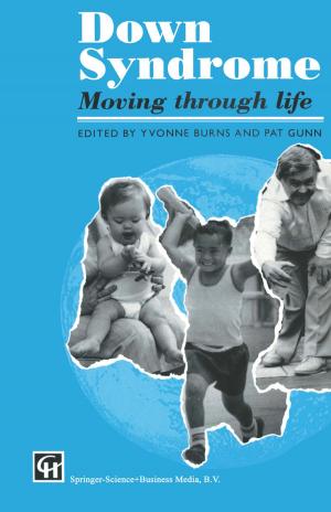 Cover of the book Down Syndrome by Forrest B. Tyler