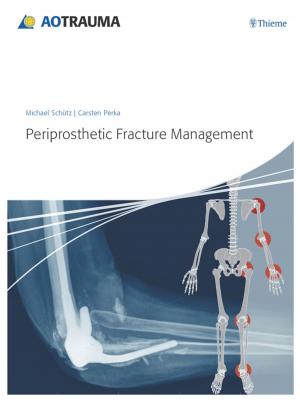 Cover of the book Periprosthetic Fracture Management by John L. Wobig, Roger A. Dailey